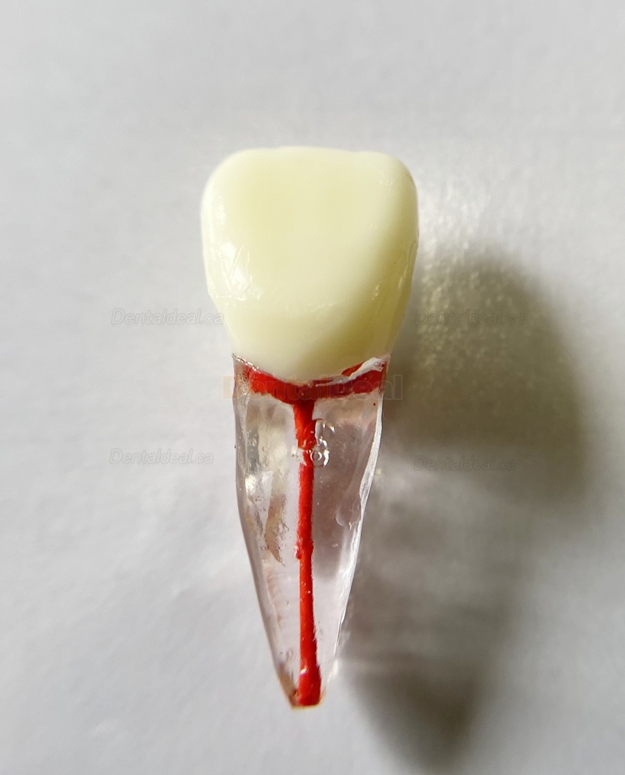 Dental Teeth Practice Model Endo File Molar Upper Lower Tooth Premolar Root 2/3-Rooted Canal